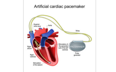 Implantable Devices