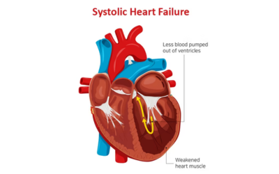 Systolic Heart Failure and Treatment at Terna Hospital Navi Mumbai