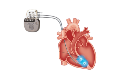 Implantable Devices