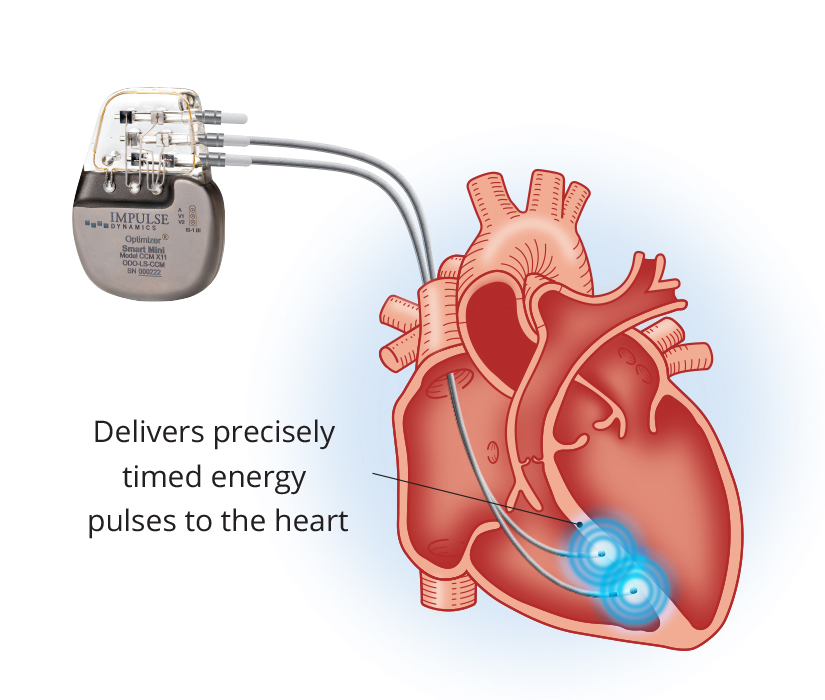 Implantable Devices in Heart Treatment