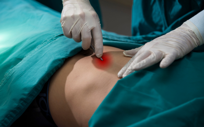 Minimally Invasive Techniques MIS