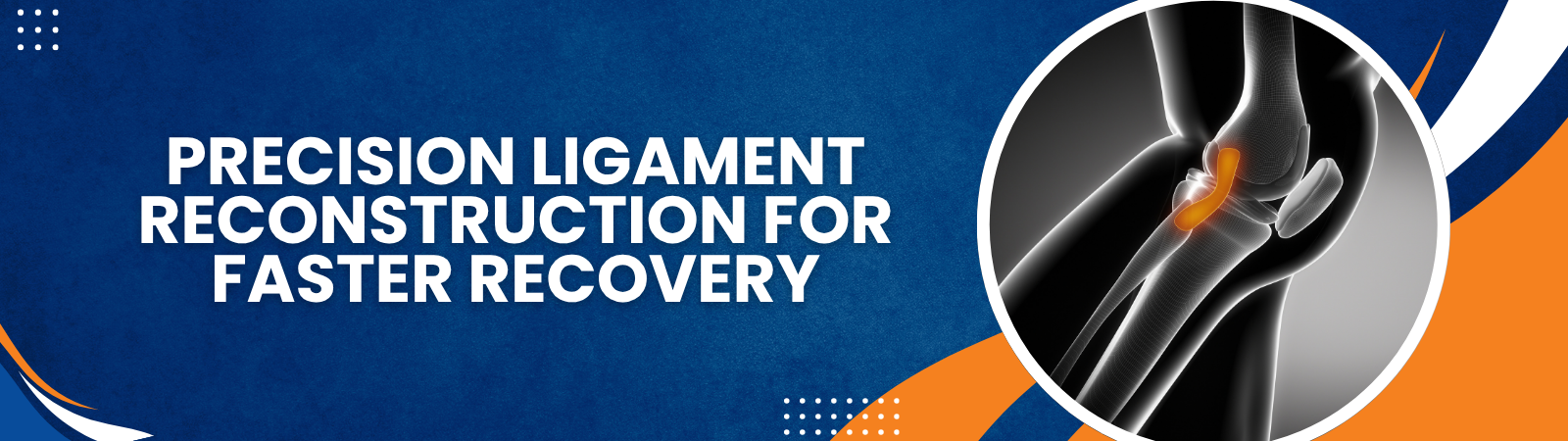 PrecisionLigamentReconstructionforFasterRecovery