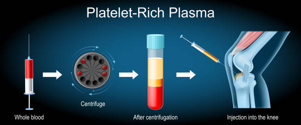 PRP process