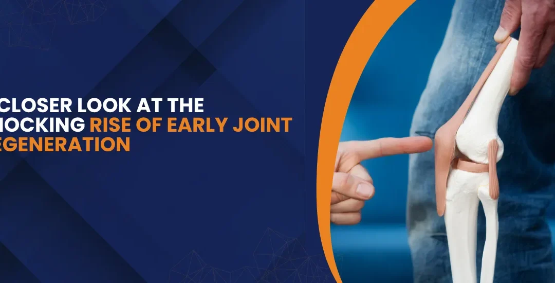 Why Are So Many Young Adults Developing Osteoarthritis?