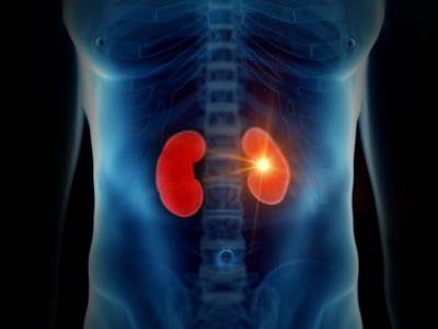 Acute Kidney Injury Terna Hospital