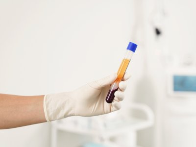 Plasmapheresis
