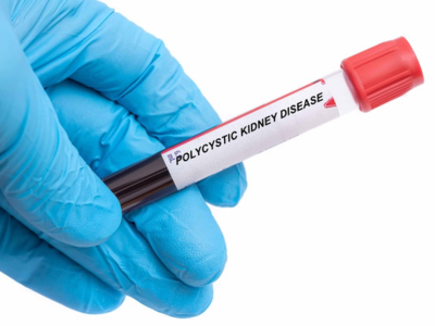 Polycystic Kidney Disease Terna Hospital