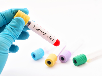 Renal Biopsy