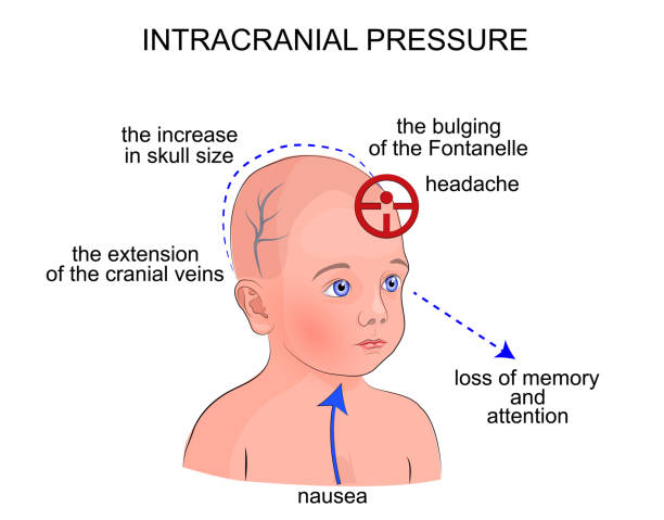Pediatricneurosurgery Pediatric Neurosurgery