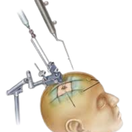 Stereotactic Navigation Systems Terna Hospital Stereotactic Navigation Systems