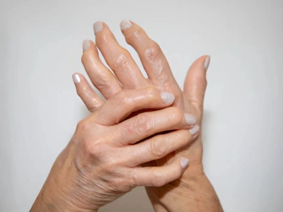 Rheumatoid Arthritis RA Terna Hospital 3T MRI High Resolution CT Scans