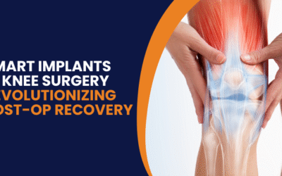 Smart Implants in Knee Surgery – How Sensors Are Changing Post-Op Recovery