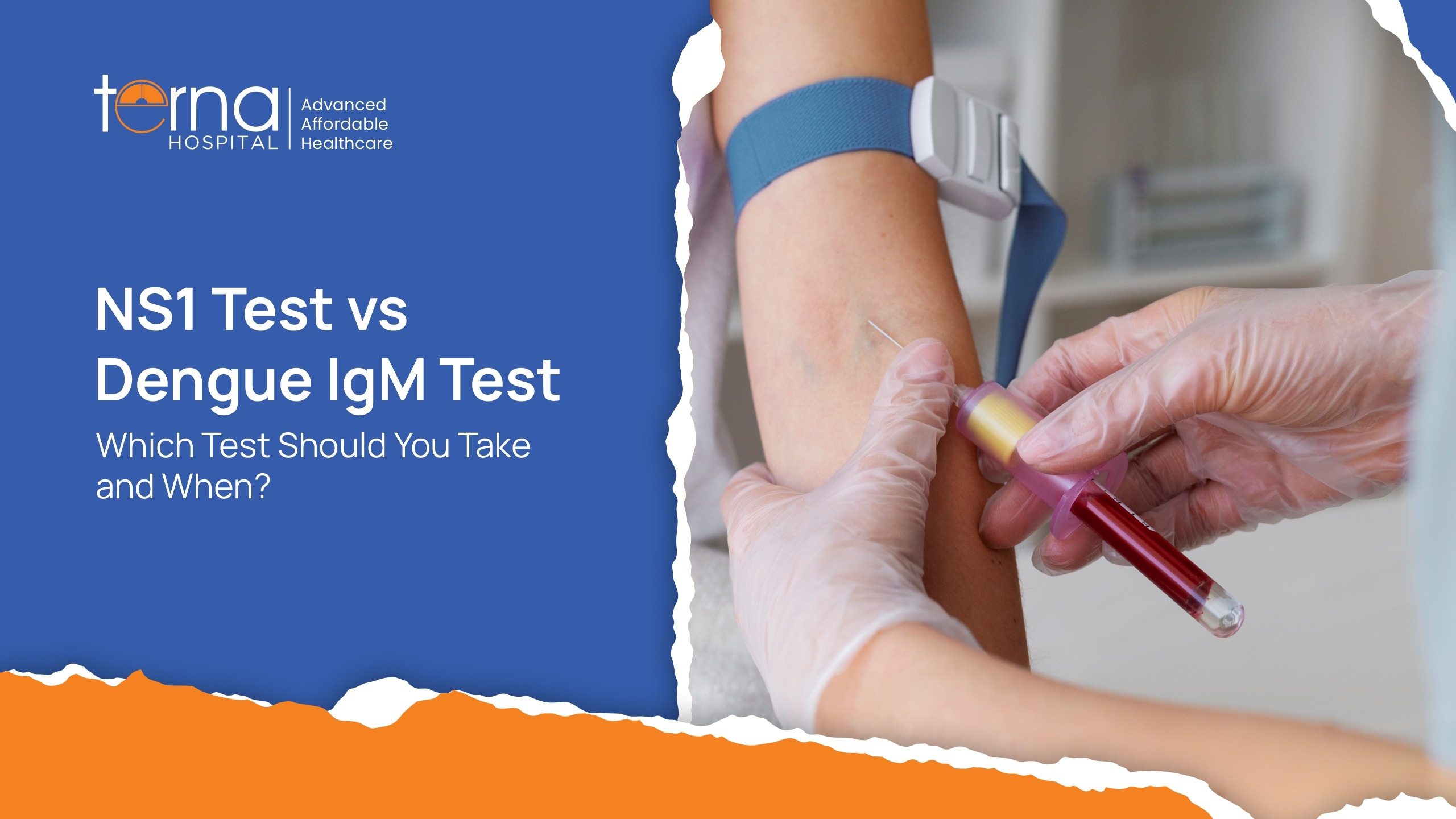NS1 Test vs Dengue IgM Test: Which Test Should You Take and When?