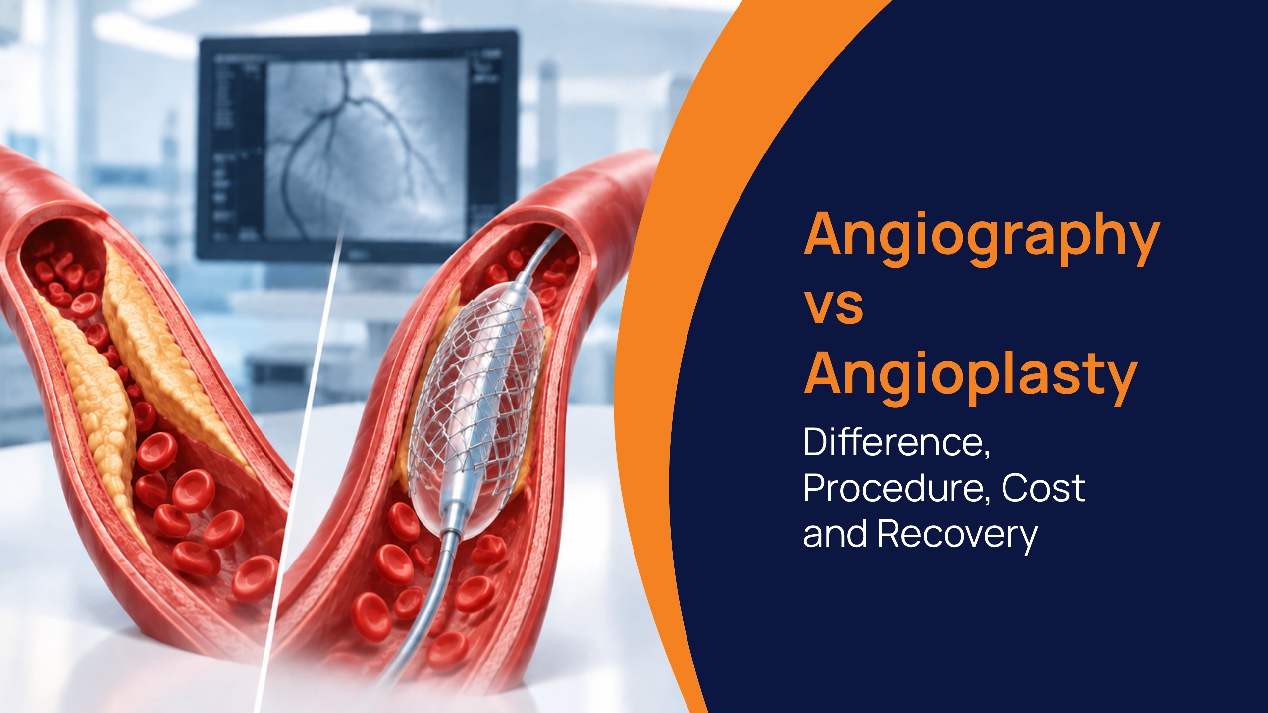 Angiography vs. Angioplasty: Key Differences, Procedure, Cost, Risks, and Recovery Time